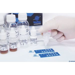 Ana-Hep-2 Imunofluorescência Imuno-Con 100 Testes - Wama